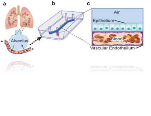 A diagram of pulmonary thrombosis